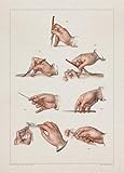 Anatomy SCALPEL LANCET INCISION print SRA3 12x18 conqueror laid paper